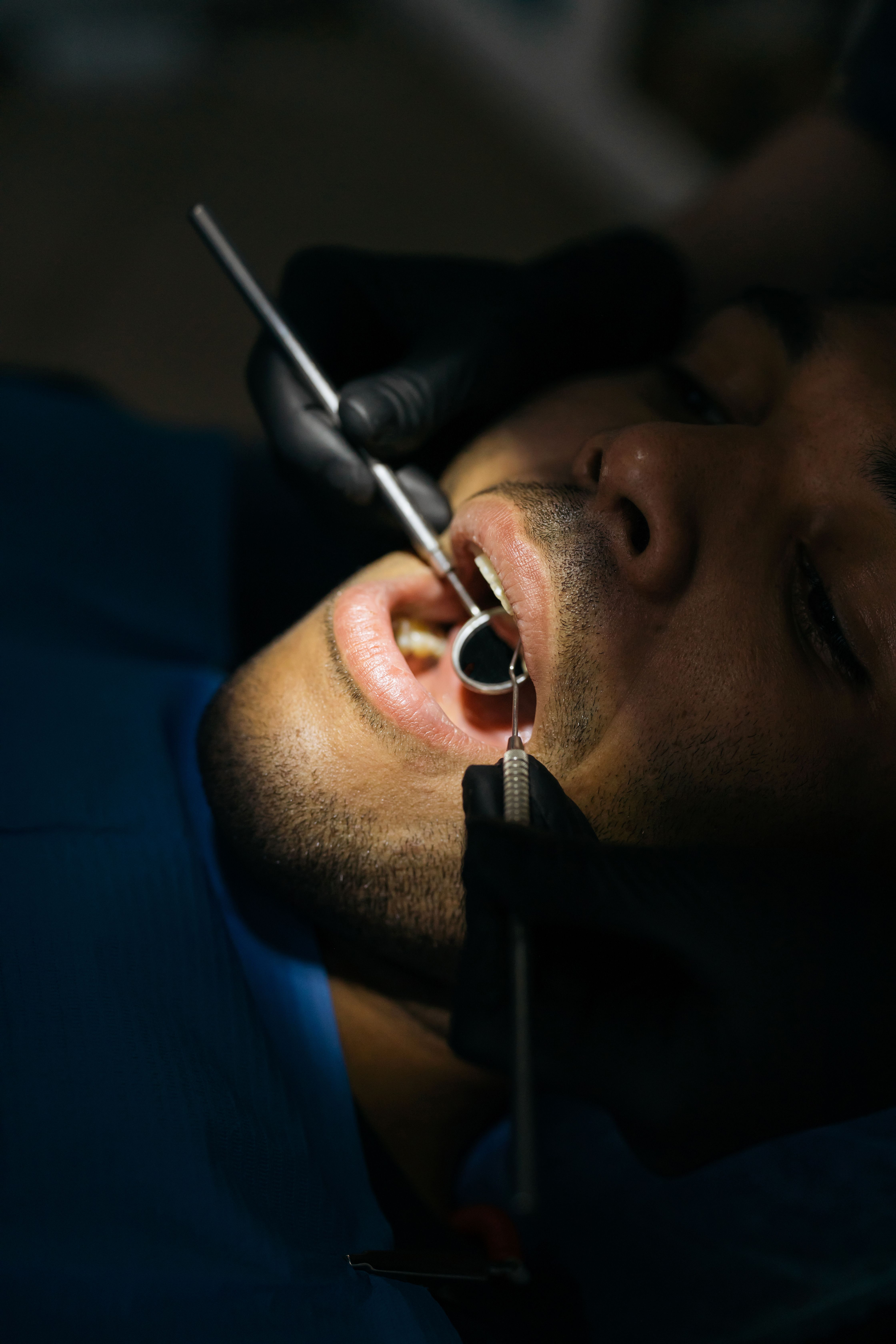 Teeth whitening maintenance