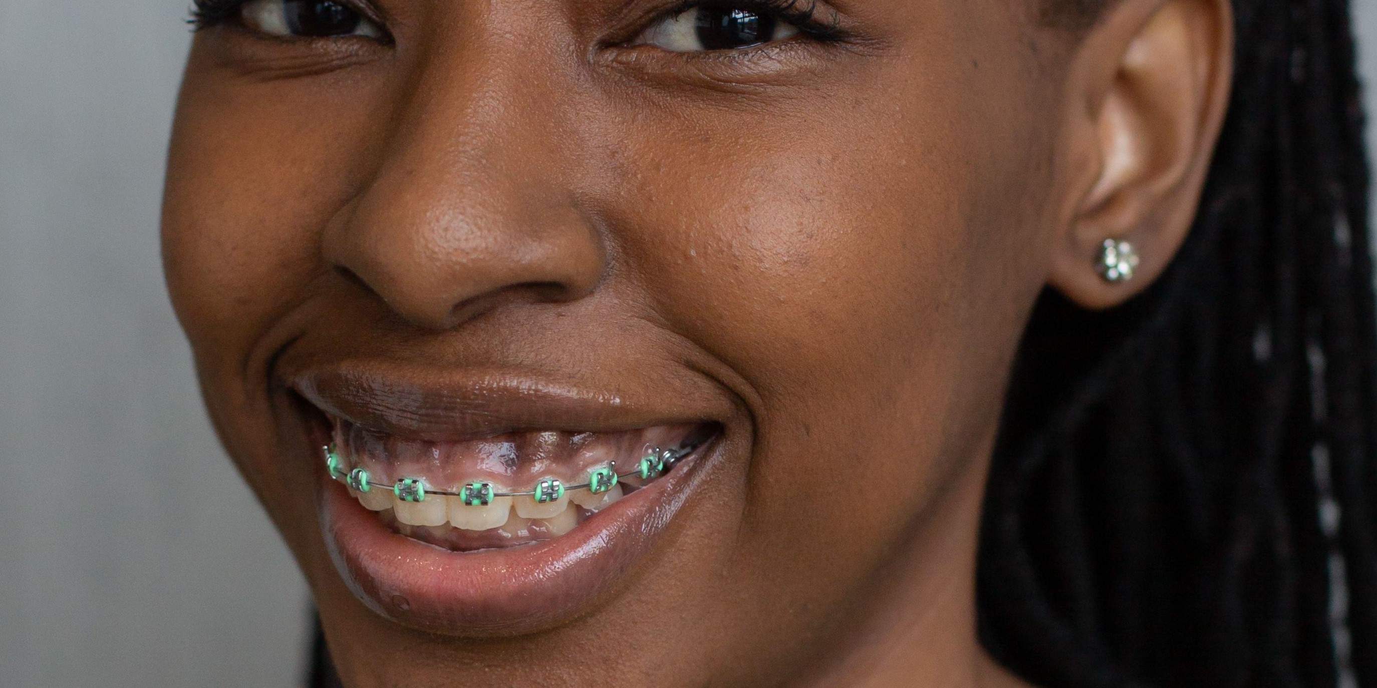 Orthodontic braces
